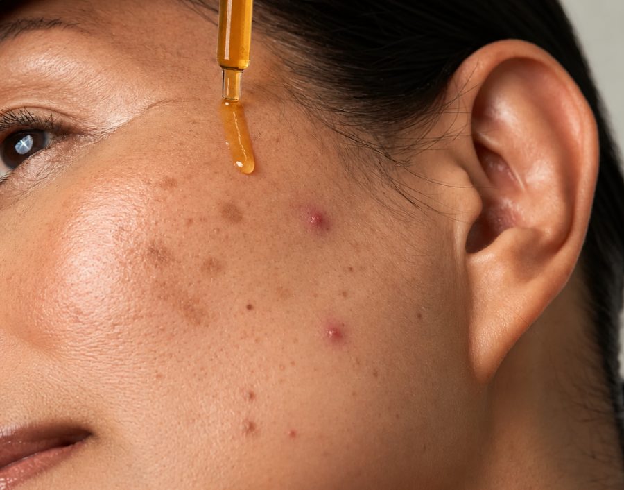 A simple skincare routine